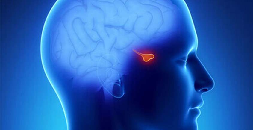 Αδενώματα Υπόφυσης